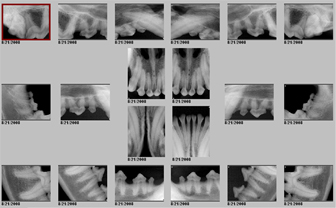 Dental Care and Procedures